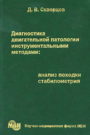 Диагностика двигательной патологии инструментальными методами. Анализ походки. Стабилометрия