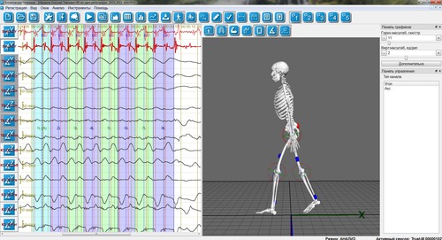 Рис.1 ПО Биомеханика-Неврокор