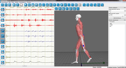 Рис.2 ПО Биомеханика-Неврокор. ЭМГ