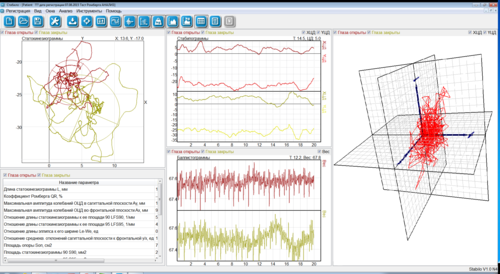Рис. 3.ПО Стабилометрия-Неврокор