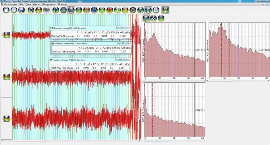 Рис. 4. Экран стабилометрического исследования с анализом спектра частот и таблицами количественных показателей.